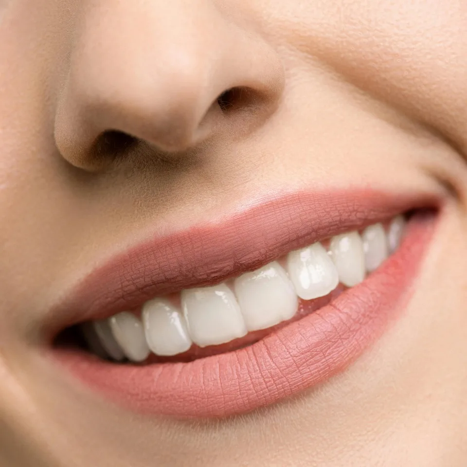 diseno-sonrisa