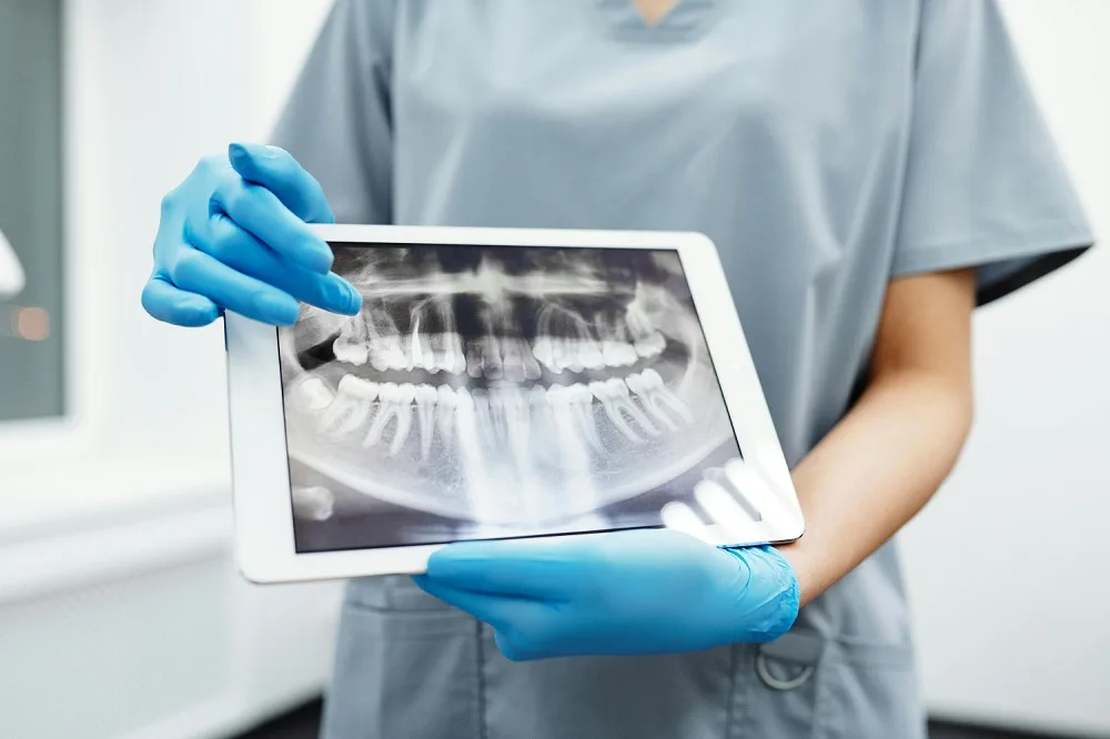 odontologia-restauradora