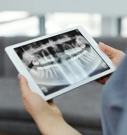 radiografia